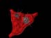 test11